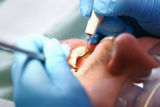 Best Broken or Cracked Tooth Emergency Dentist in Ata, OK