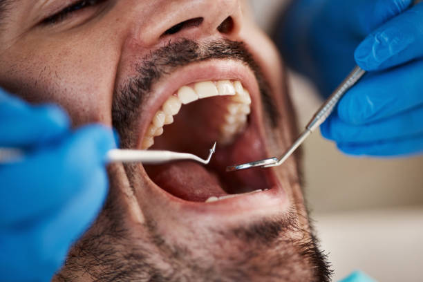 Best Emergency Dental Services for Seniors in Ata, OK